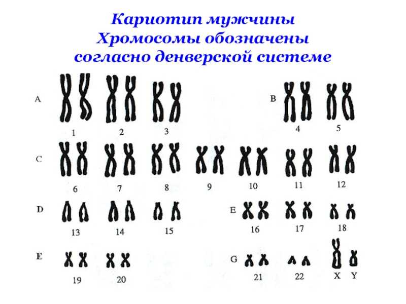 Какую форму имеет хромосома. Кольцевую хромосому имеет. Хромосомы пола исключения курица. Хромосомы 21 18 13 что означает.