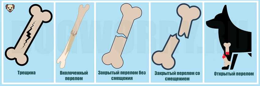 Лечение острых травм спинного мозга: переломов и вывихов