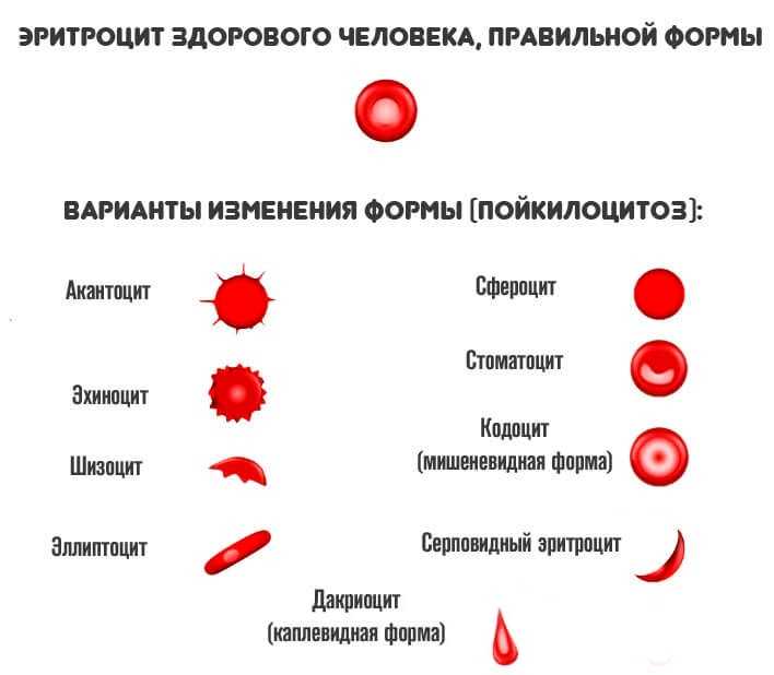 Эритроциты понижены у мужчины причины. Эритроциты кольцевидной формы. Красные клетки крови. Патологические формы эритроцитов. Сферическая форма эритроцитов.