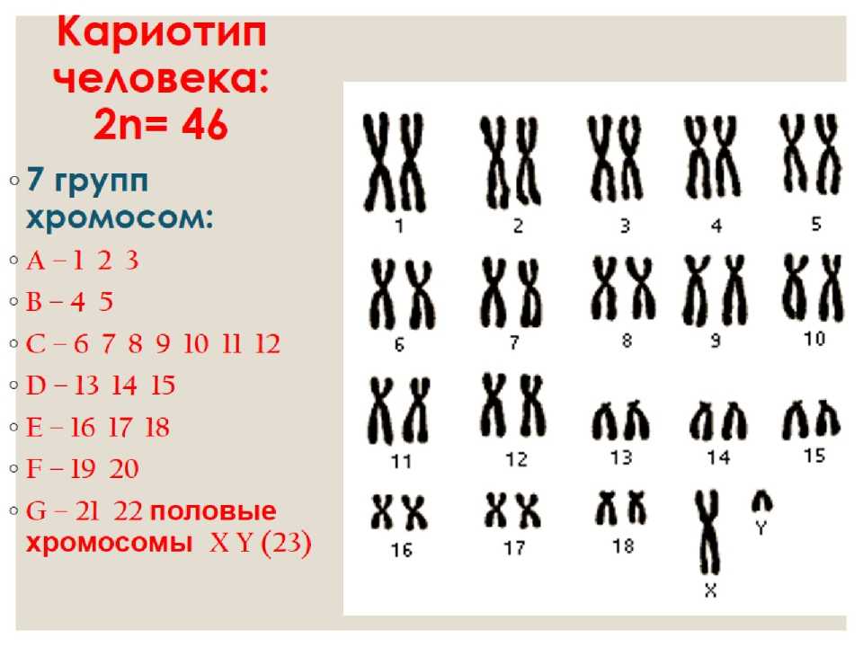 Схема хромосомного набора. Кариотип набор хромосом 2n2c. Нормальный кариотип человека 46 хромосом. Хромосомный набор кариотип человека рисунок. Хромосомная карта кариотип.