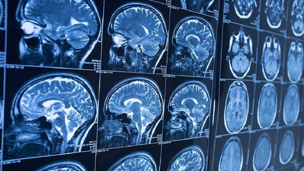 Мрт головного мозга - современная и точная диагностика