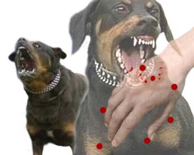 Признаки бешенства после укуса собаки у человека | симптомы у людей, как заразиться