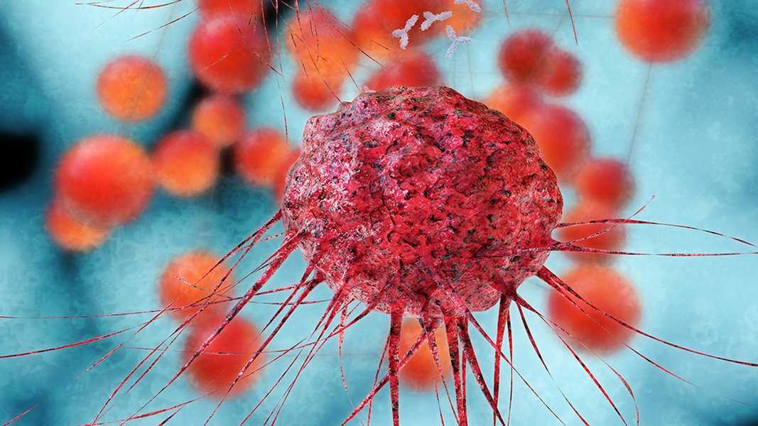 Раковые клетки: чем питаются в организме человека? как выглядит раковая клетка, что это такое, раковые клетки под микроскопом | клиники «евроонко»