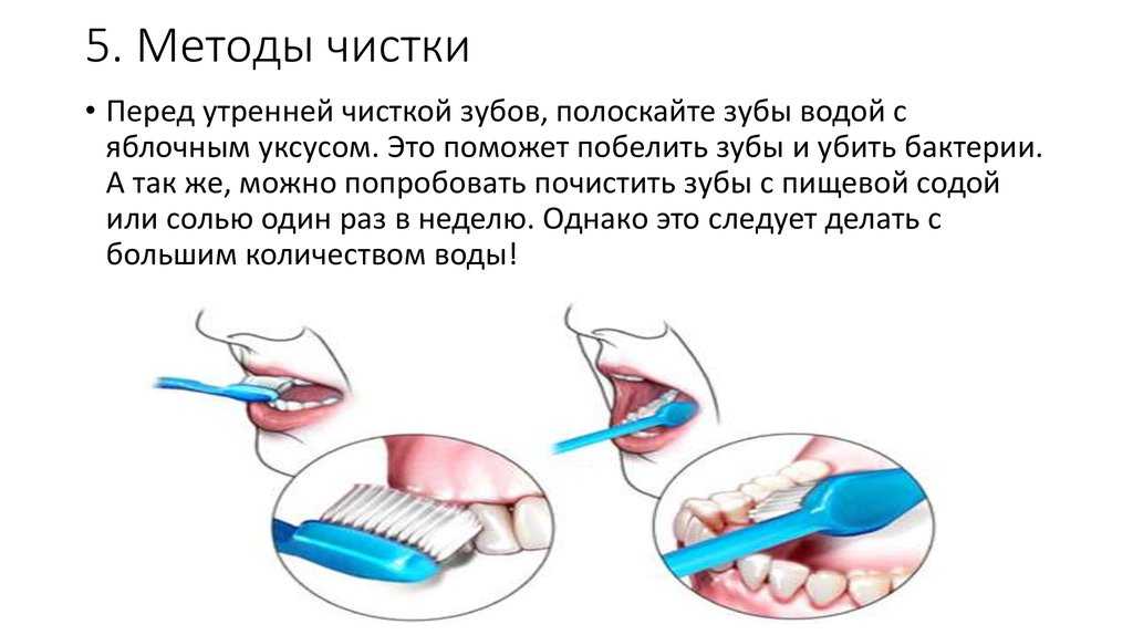 Можно ли чистить зубы ребенку. Методы чистки зубов стандартный метод. Методы чистки зубов: стандартный метод чистки. Методы чистки зубов ( метод Марталлера).. Методы чистки зубов в стоматологии.